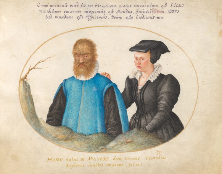 A painting of a man with hypertrichosis next to a woman